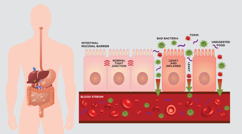 1- Leaky Gut and weight gain go hand in hand here is what you can do | Biom|||leaky-gut