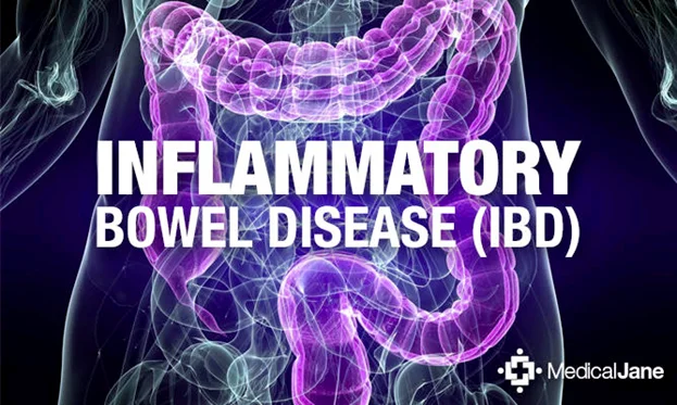 1- News | BIOM Probiotics | Sarasota | Microbiome’s health | Inflammatory Bowel Disease