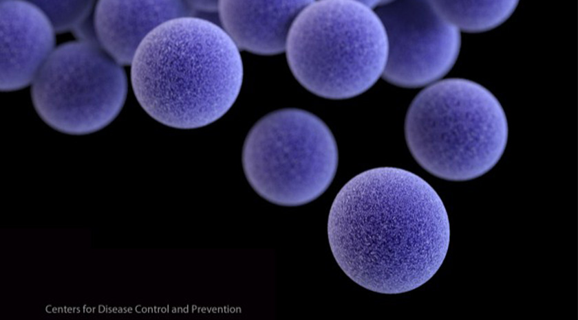 1- Digestive Supplements | Studies Shows Probiotic Bacillus Clear MRSA