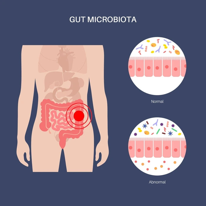 Microbiome Diet