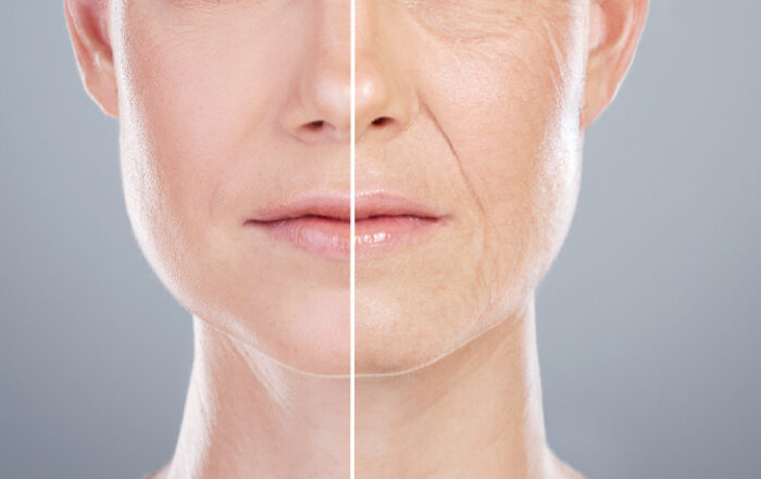 Anti-Inflammatory Power of Probiotics