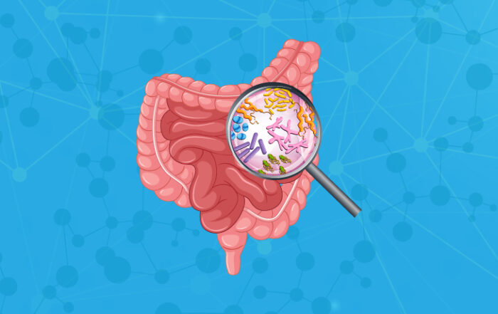 Gut dysbiosis