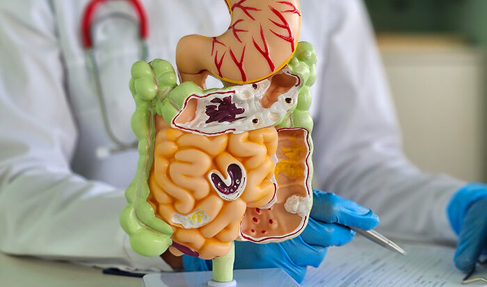 How to Improve Gut Health